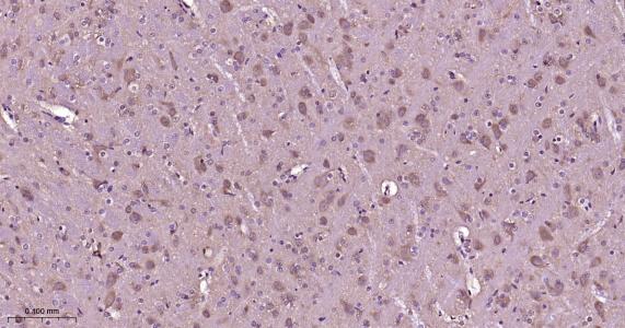 p21激活激酶1重组兔单抗