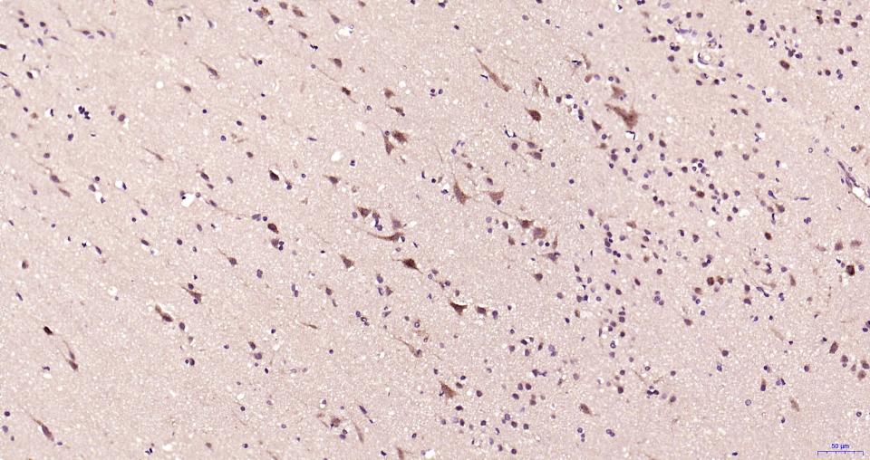 丝裂原活化蛋白激酶激酶2重组兔单抗