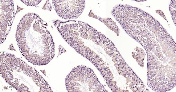 硫氧环蛋白还原酶1重组兔单抗