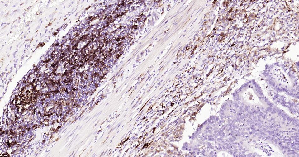 HLA-DR重组兔单抗