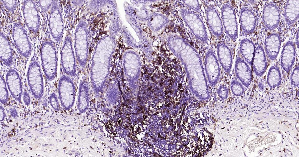 HLA-DR重组兔单抗