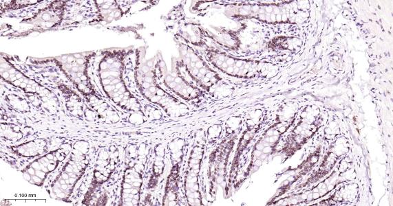 肝细胞核因子4α重组兔单抗