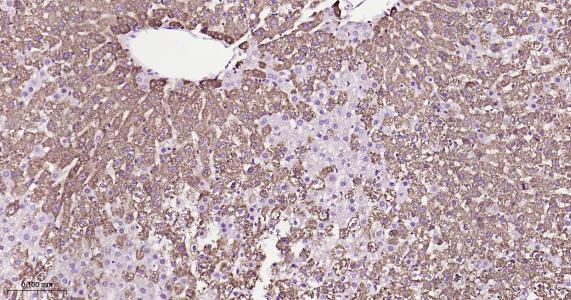 ATP5A重组兔单抗