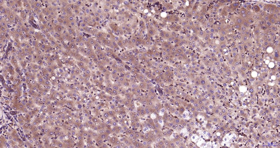 丝裂原活化蛋白激酶激酶2重组兔单抗