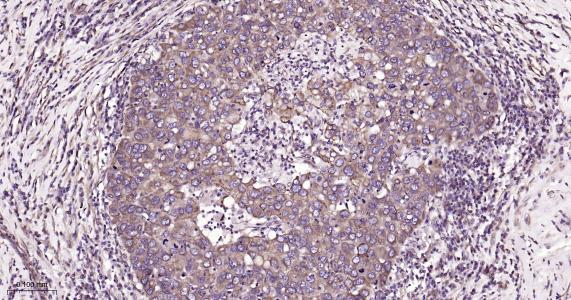微管蛋白β1 tubulin(内参)重组兔单抗