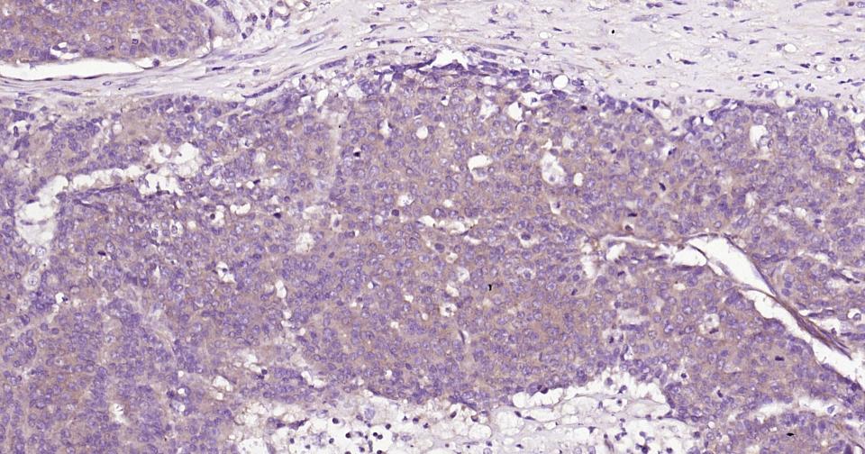 Rho相关蛋白激酶1重组兔单抗