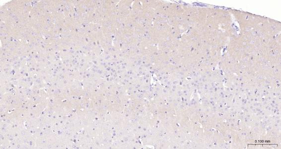 G氨基丁酸B型受体2重组兔单抗
