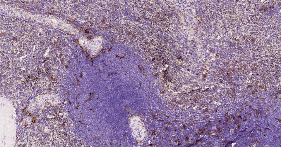 整合素αX重组兔单抗