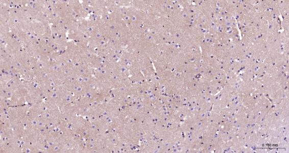 整合素整合素αV（CD51）抗体-bs-1310R