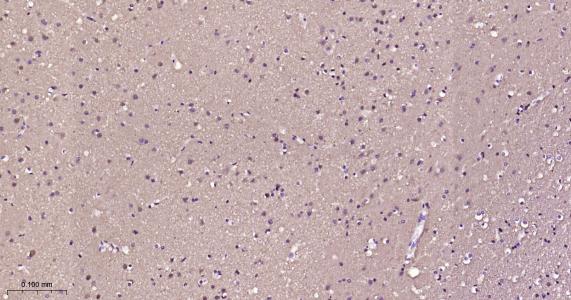 神经细胞胞浆蛋白9.5重组兔单抗