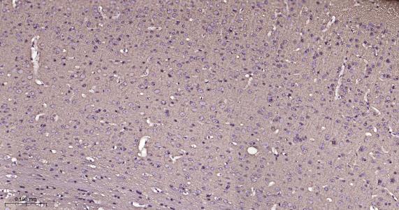 微管蛋白β1 tubulin(内参)重组兔单抗