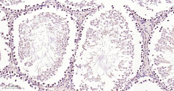 硫氧环蛋白还原酶1重组兔单抗