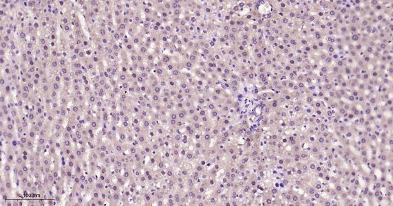 硫氧环蛋白还原酶1重组兔单抗