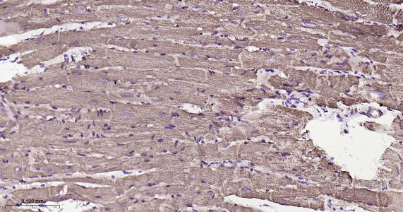 ATP5A重组兔单抗