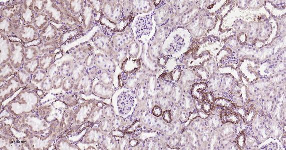 ATP5A重组兔单抗