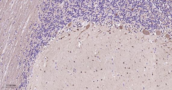 神经细胞胞浆蛋白9.5重组兔单抗