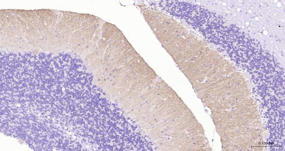 G氨基丁酸B型受体2重组兔单抗