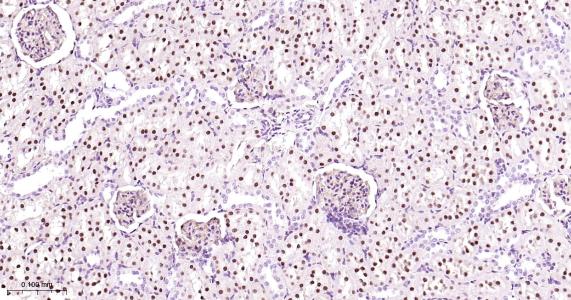 肝细胞核因子4α重组兔单抗
