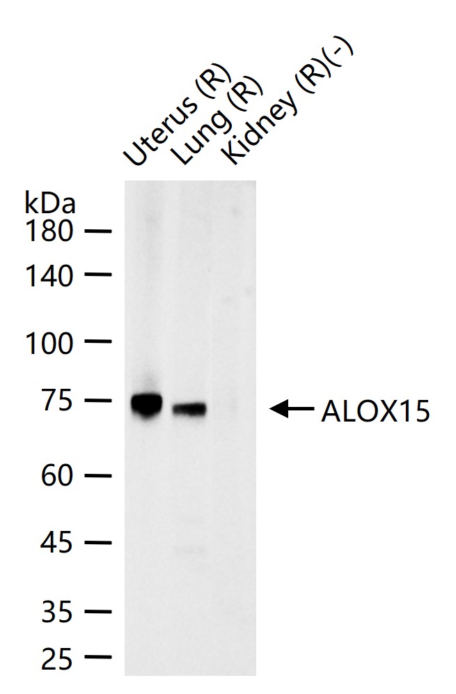 ALOX15 Rabbit pAb (一抗) | Bioss