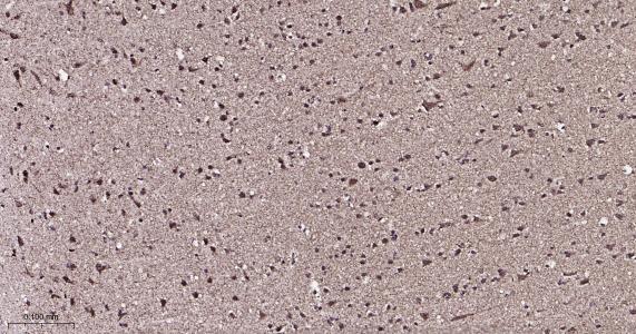 ATP5A重组兔单抗