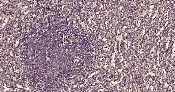 微管蛋白β1 tubulin(内参)重组兔单抗
