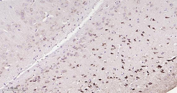 ATP5A重组兔单抗