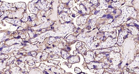 整合素整合素αV（CD51）抗体-bs-1310R