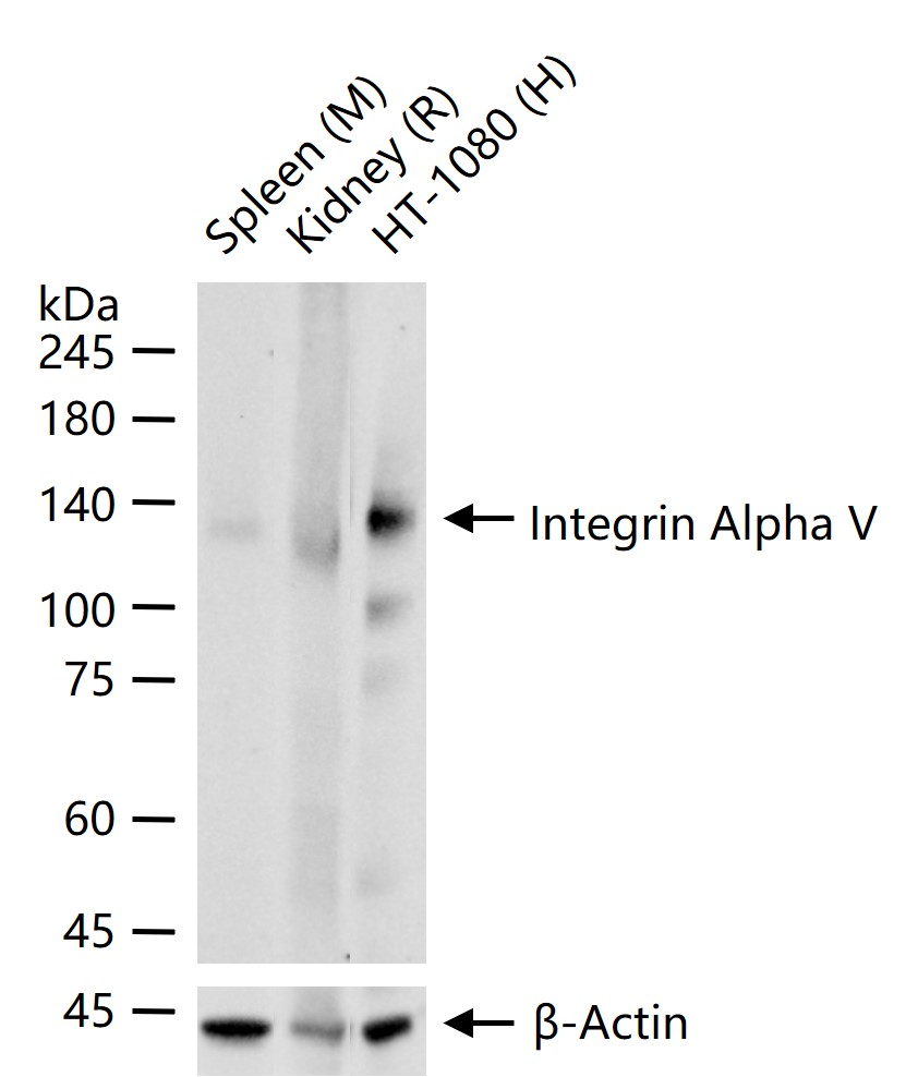 Integrin Alpha V Rabbit pAb (一抗) - WB,IHC-P,IHC-F,IF,IP | Bioss