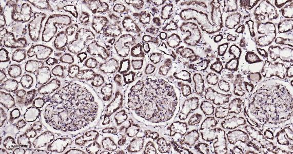 ATP5A重组兔单抗