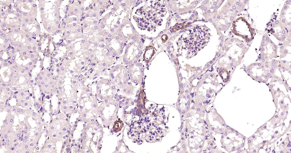Rho相关蛋白激酶1重组兔单抗