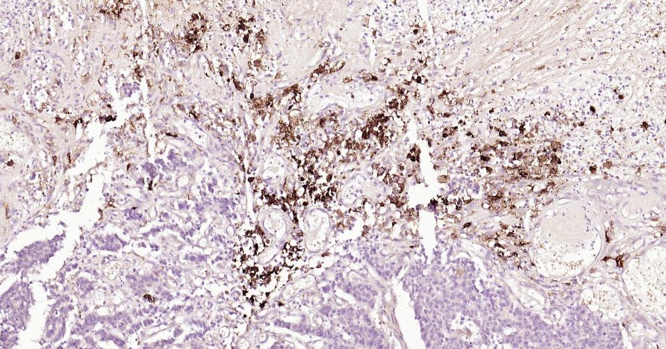 HLA-DR重组兔单抗