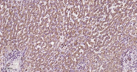 ATP5A重组兔单抗