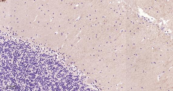 谷氨酸受体1重组兔单抗