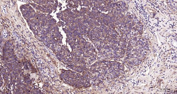 整合素整合素αV（CD51）抗体-bs-1310R