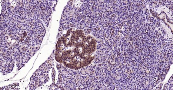 硫氧环蛋白还原酶1重组兔单抗