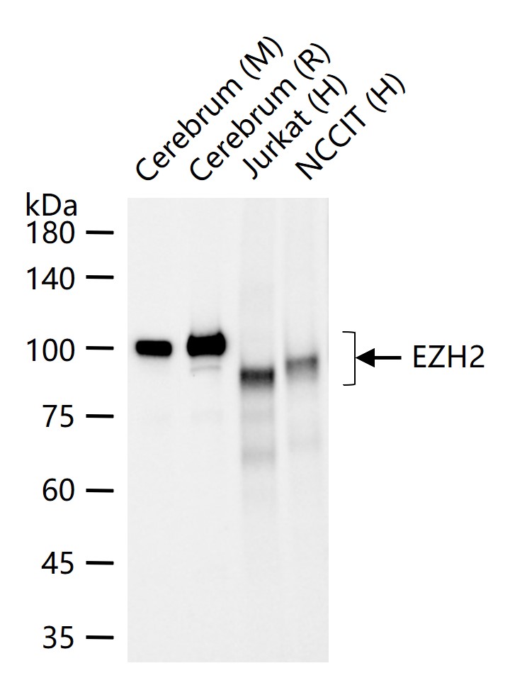 抑癌蛋白EZH2重组兔单抗