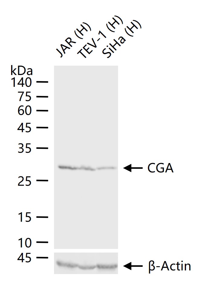 促甲状腺激素α重组兔单抗