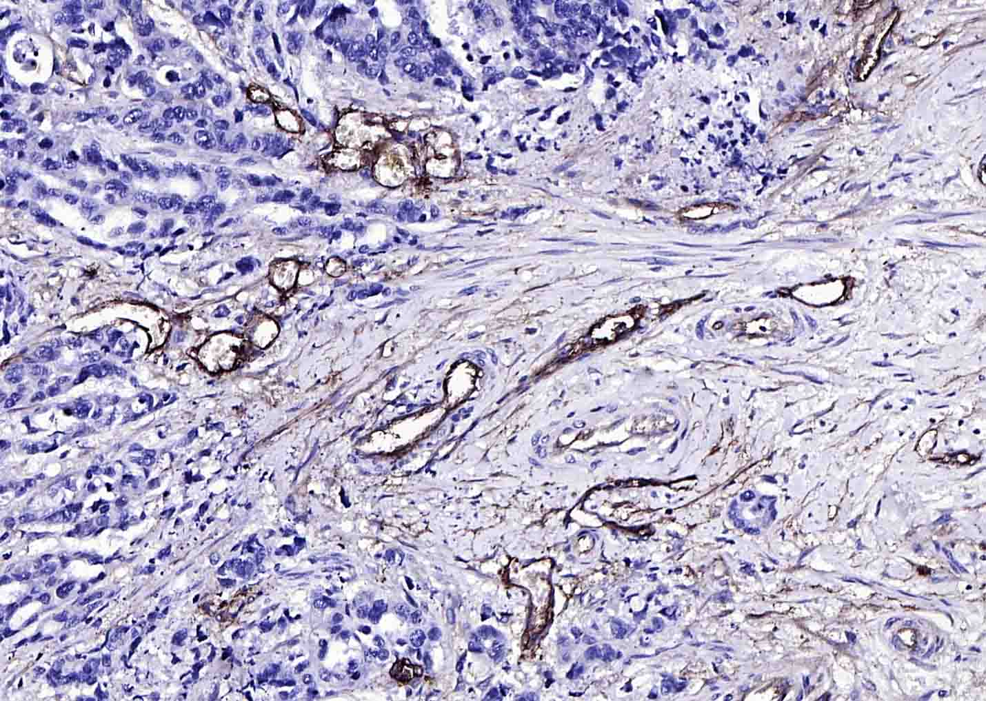 CD105 Rabbit pAb (一抗) - IHC-P,IHC-F,Flow-Cyt,IF | Bioss