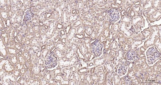 列腺素E2受体2重组兔单抗