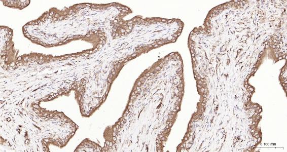 列腺素E2受体2重组兔单抗