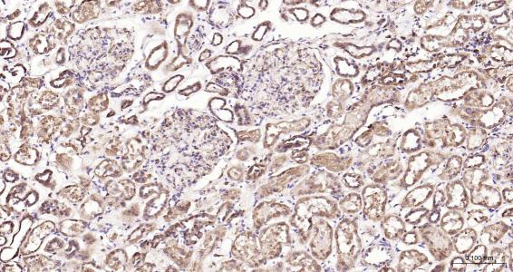 列腺素E2受体2重组兔单抗