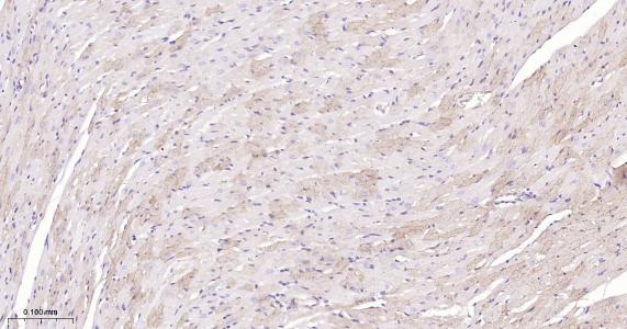 肾上腺素能受体β2重组兔单抗