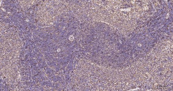 列腺素E2受体2重组兔单抗