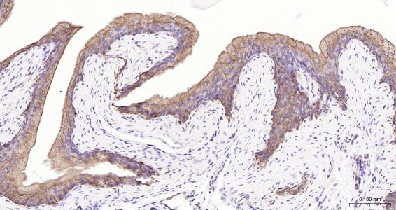 列腺素E2受体2重组兔单抗