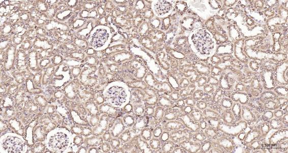 列腺素E2受体2重组兔单抗