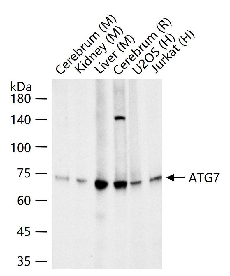 自噬相关蛋白7重组兔单抗