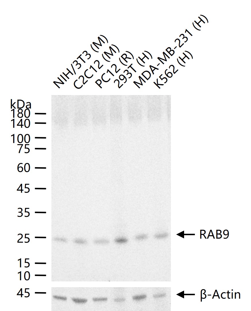 RAB9 Recombinant Rabbit mAb (一抗) | Bioss