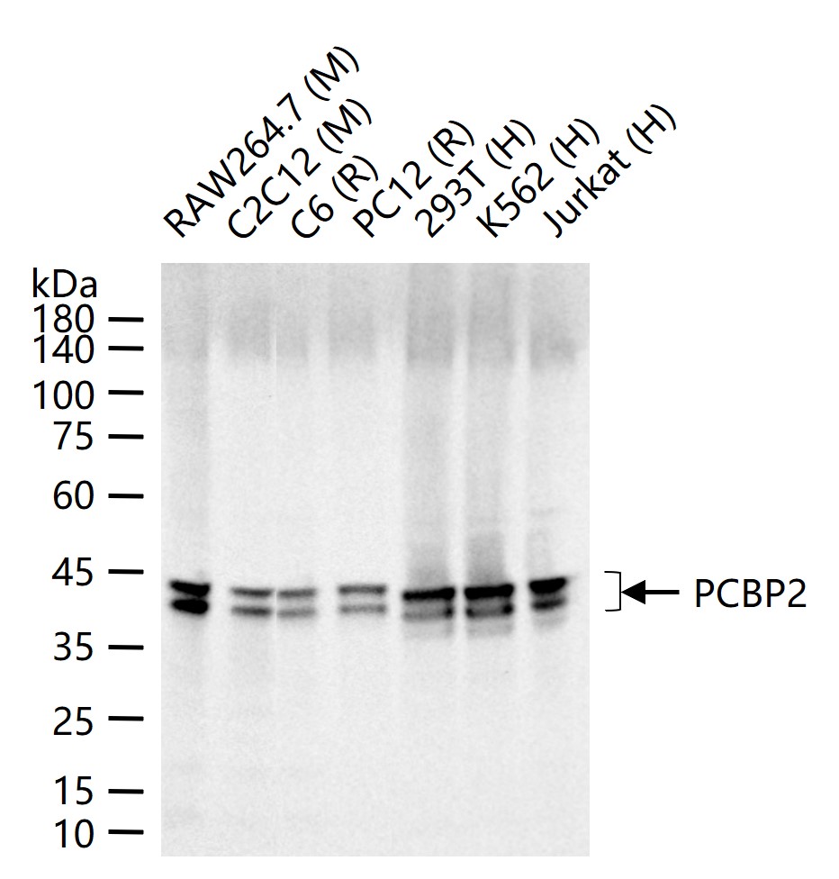 异构核糖核蛋白E2重组兔单抗