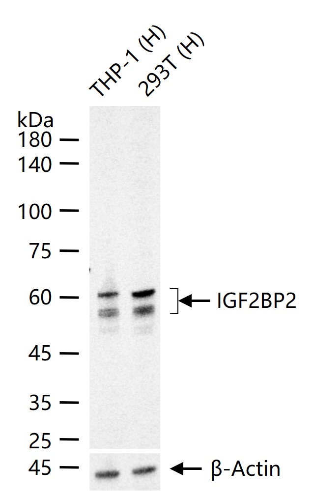 胰岛素样生长因子ⅡmRNA结合蛋白2重组兔单抗