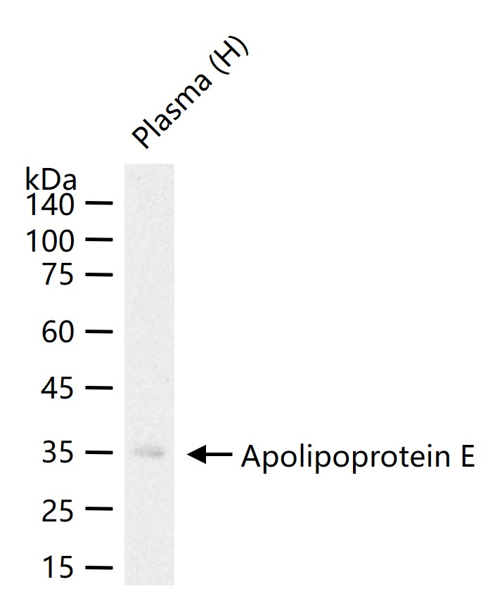 载脂蛋白E重组兔单抗